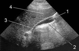 Узи желчного Киев